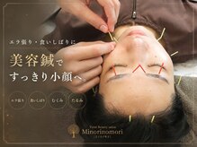 ミノリノモリ(Minorinomori)