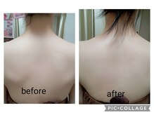 トータルエステティック ライム(lime)/運動なしで!!サーモシェイプ痩身