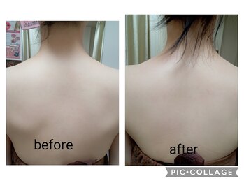 エステティック ライム(Esthetic Lime)/運動なしで!!サーモシェイプ痩身