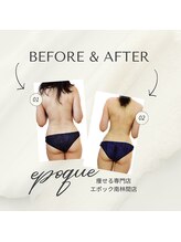 エステティックサロン エポック(epoque)/ＴMキューブ★スリムボディへ