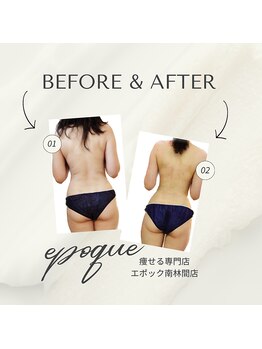 エステティックサロン エポック(epoque)/TMキューブ★スリムボディへ