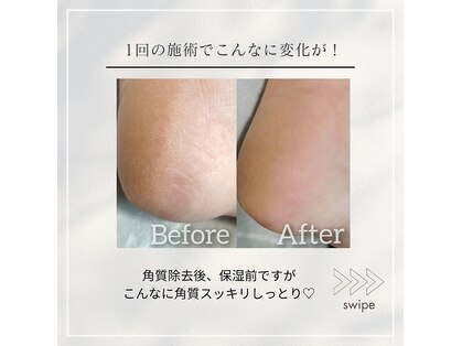 リミナ(Rimyna)の写真