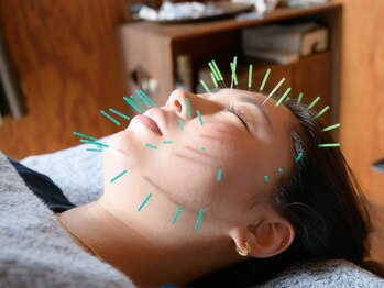 マヒナラボ 湘南(Mahina.lab)の写真/東洋医学などベストな要素を融合！次世代かつワンランク上の美容鍼で健康美を追求したい方に◎