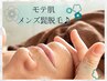 【メンズヒゲ脱毛】口周りのヒゲに☆美肌脱毛　通常¥6,300