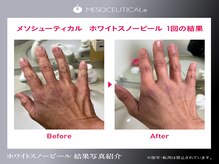 ホロホロ(holoholo)の雰囲気（完全個室でリラックスしながら驚愕リフトアップ）
