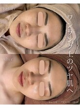 エメ(Aimee)&nbsp;ワンランク 上のツヤ肌