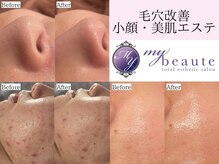 マイボーテ 自由が丘店(my beaute)