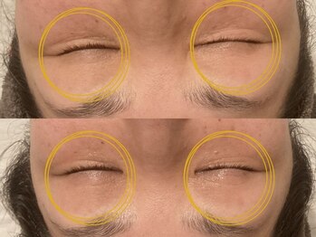 シェリー(CHERIE)/フェイシャルマッサージ