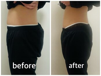 YOSAPARK Lulua/before*after