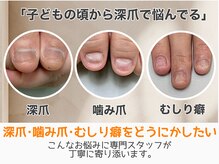 レアム/どうしたらいいかわからない方へ