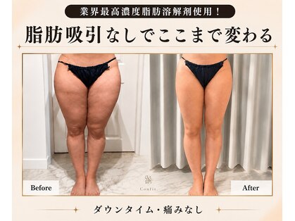 リオ(Rio)の写真