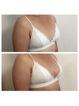 ミント(M’int)/バストサイズアップ希望の方