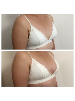 ミント(M’int)/バストサイズアップ希望の方