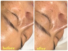 ベルドア(Bell Door)/エイジングケア