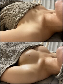 美 プラス(美 Plus)/【産後バストのお悩み】