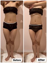 ルミナス 八尾店(Luminous)/痩身ビフォー・アフター