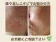 エクラの写真