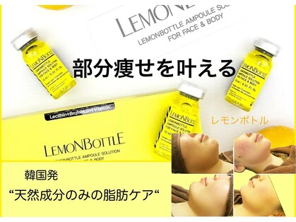 ロージースマイル(Rosy smile)の写真