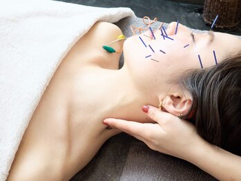 ソエルテの写真/【美容鍼が初めての方も◎】小顔矯正×美顔鍼セットで変化を実感。鏡を見るのが楽しく自信の持てる小顔へ♪