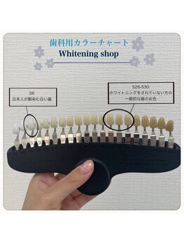 ホワイトニングショップ 葵区静岡駅店/ホワイトニング店ホワイトニング