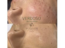 ベルーナビューティ 西新宿(Beluna beauty)の雰囲気（韓国の女優・アナウンサーも愛用の実力派コスメで肌質改善）