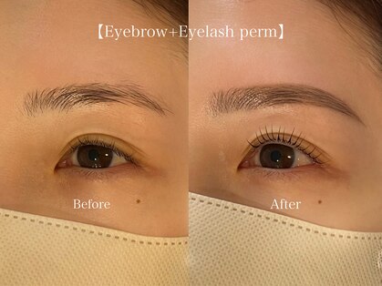 パー(purr)の写真