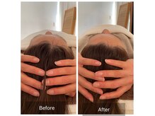 話題沸騰中のPARAFUSE(小顔脳洗浄)を是非ご体感ください◎