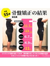 セレンディピティ 緑店(Serendypity)/５５歳　骨盤ダイエットの結果