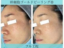 リメイククリニカルビューティー(Remake clinical beauty)/長年の蓄積