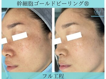 リメイククリニカルビューティー(Remake clinical beauty)/長年の蓄積