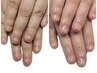 ◇ご予約用◇【ハンド/深爪矯正】コースの方はこちらから☆
