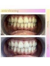 エクシアホワイトニング 新白河店/ホワイトニングサロン新白河店