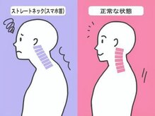 240鍼灸マッサージ院 麻布十番/スマホ首/ストレートネック/整体