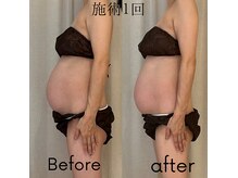 アカアカ('AKA'AKA)の雰囲気（全身マタニディケア　90分）