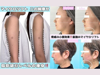 小顔専門カンナムビューティー　上野店【ララピール/ハーブピーリング/小顔/痩身】の写真