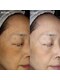 リアルナ(REALUNA)の写真/年々増えていくシミ・小じわ正をしいアプローチで改善◎これ以上増やさないケアのご提案も！