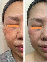 ビューティーワークス シャンティ 新鎌ヶ谷店(Beauty Works Shanti)/お客様の成果☆4枚目