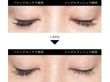 チャーム 近江八幡店(Charm)/バインドロック