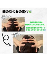 ラクリエ 東加古川院(La Creer)/お客様ビフォーアフター