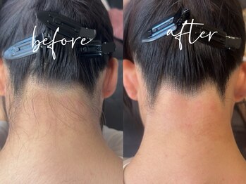 ルシェリアノーブル(le cherien noble)/Wax脱毛