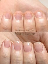 マリーロール 淀屋橋本店(Marie Laure)/自爪育成/深爪矯正/ネイルケア