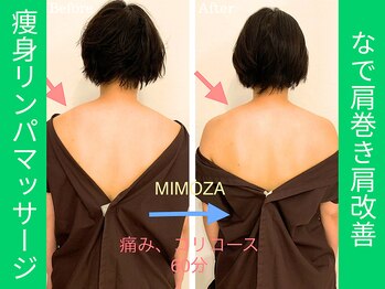 ミモザ鍼サロン(mimoza鍼サロン)/ガチガチ首肩もすっきり♪
