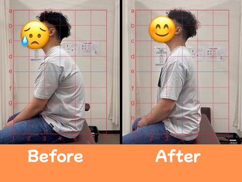 美田園5丁目接骨院/全身矯正のbefore→after