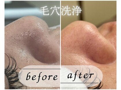 コマチ(comachi)の写真