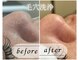 コマチ(comachi)の写真