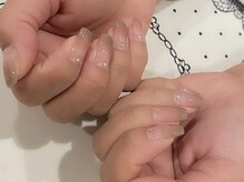 カウンセリングを徹底し、安心・安全な施術を心がけます。