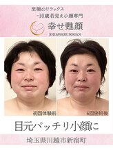 幸せ甦顔/目元パッチリ小顔に