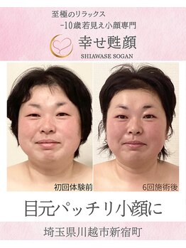 幸せ甦顔/目元パッチリ小顔に