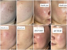 リコ(Lico)の雰囲気（お客様との信頼関係を大切にします。2人3脚で肌質改善へ導きます）