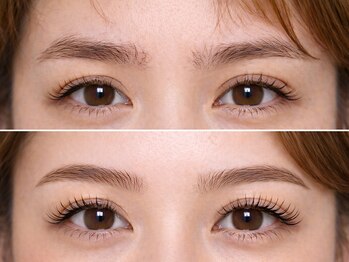 アネラ(ANELA)の写真/【フラット¥5480～/バインドロック¥8480～】目の形に合わせた提案で垢抜ける理想の目元へ★